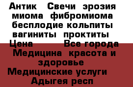 Антик.  Свечи (эрозия, миома, фибромиома, бесплодие,кольпиты, вагиниты, проктиты › Цена ­ 550 - Все города Медицина, красота и здоровье » Медицинские услуги   . Адыгея респ.